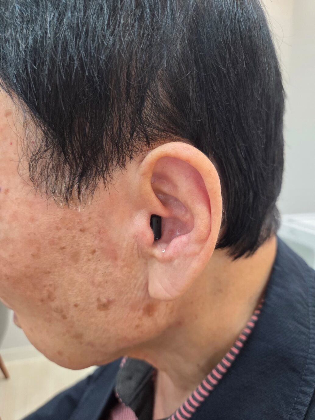 히어링허브 대구센터 보청기 소리 조절 안내 원고 사진 3